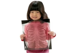 Best Røntgenbilleder - Menneske, 18 stk