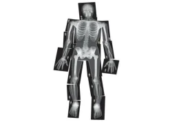 Best Røntgenbilleder - Menneske, 18 stk