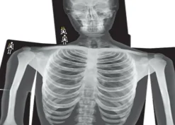 Best Røntgenbilleder - Menneske, 18 stk