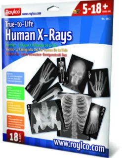 Best Røntgenbilleder - Menneske, 18 stk